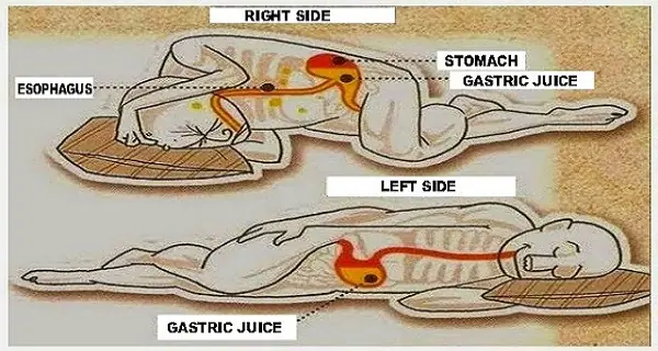 Health Benefits of Sleeping on Your Left Side