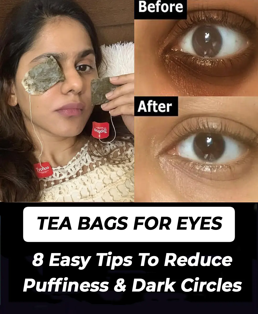 Tea bags for eyes: Follow these 8 tips to reduce puffiness and dark circles