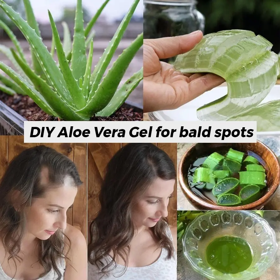 The ultimate Aloe Vera hack to regrow your hair on bald patches