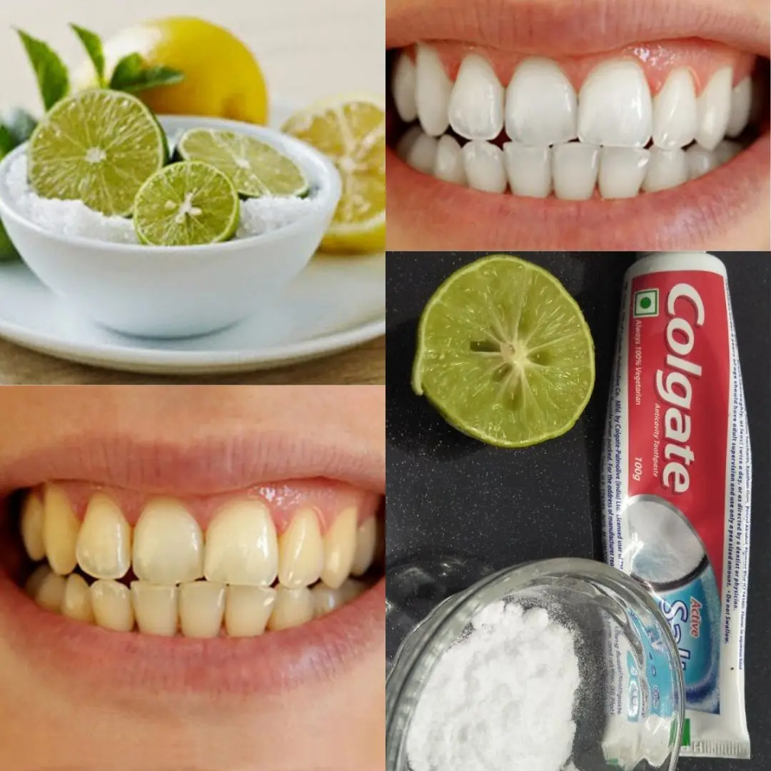 10 Natural Ways to Whiten Teeth at Home