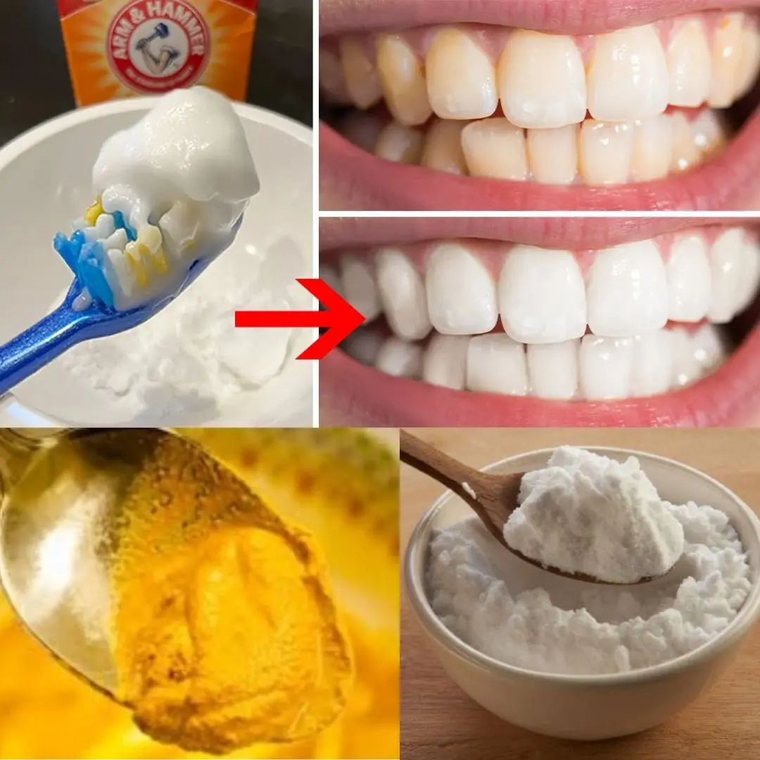 5 Natural Ways to Whiten Your Teeth at Home