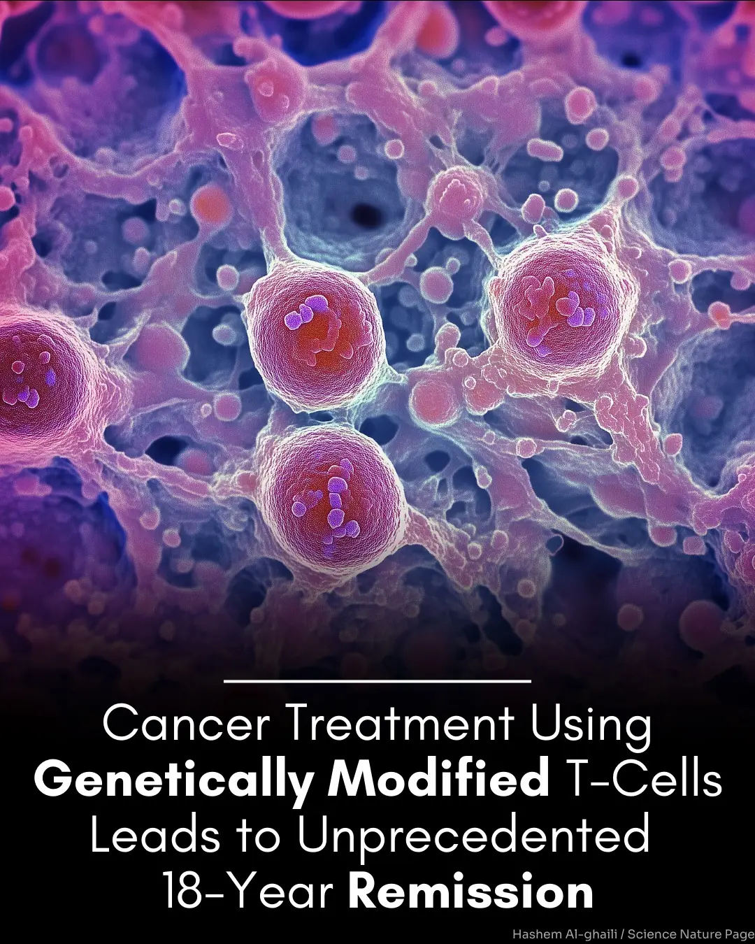 Long-term outcomes of GD2-directed CAR-T cell therapy in patients with neuroblastoma