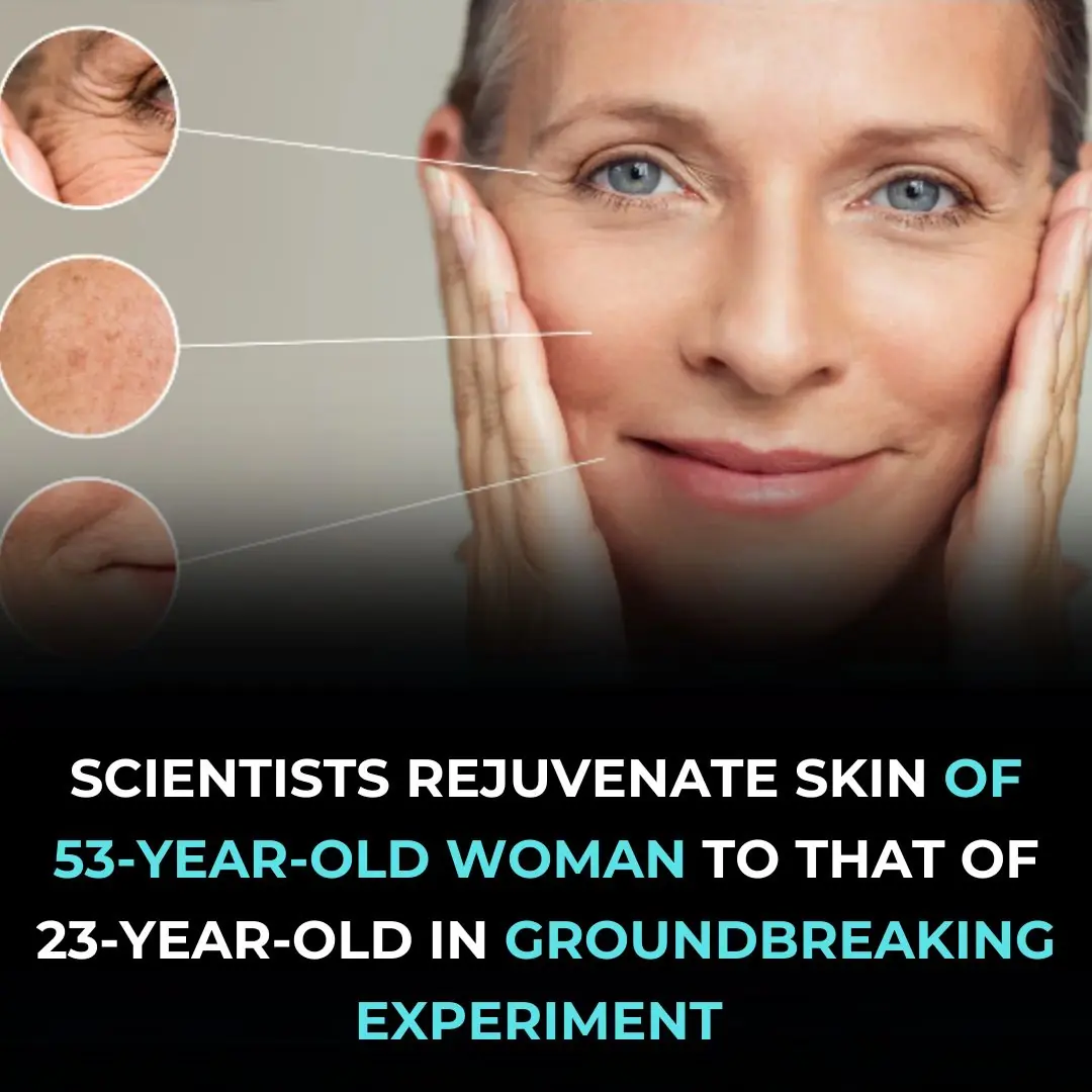 Scientists Rejuvenate Skin Of 53-Year-Old Woman To That Of 23-Year-Old In Groundbreaking Experiment