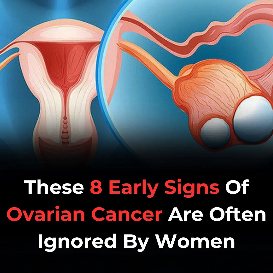 8 Early Warning Signs Of Ovarian Cancer You Shouldn’t Ignore