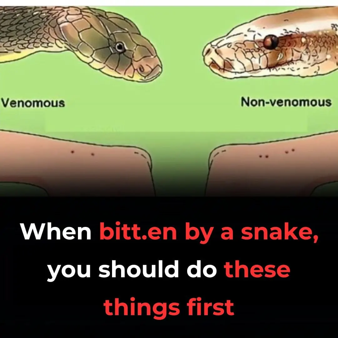 Top 6 things you need to do if you get bitten by a Snake