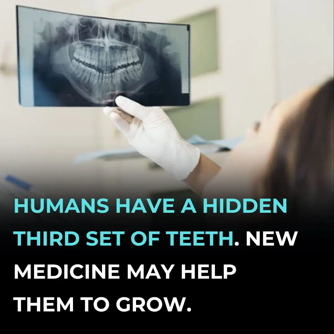 Humans Have a Hidden Third Set of Teeth. New Medicine May Help Them to Grow.