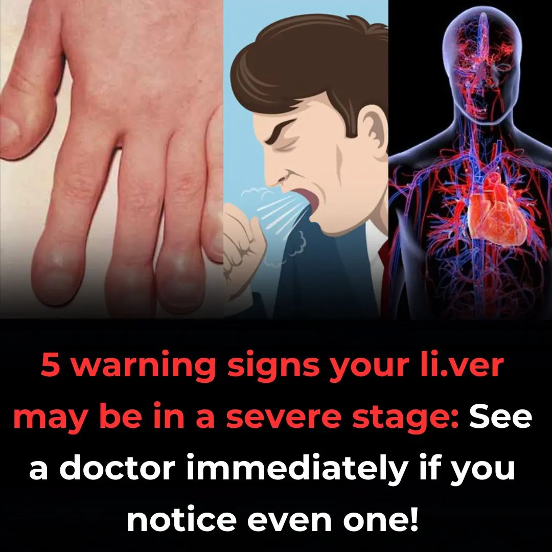 Bruising Easily? Itchy Skin? 5 Hidden Signs of Liver Damage You Might Be Overlooking