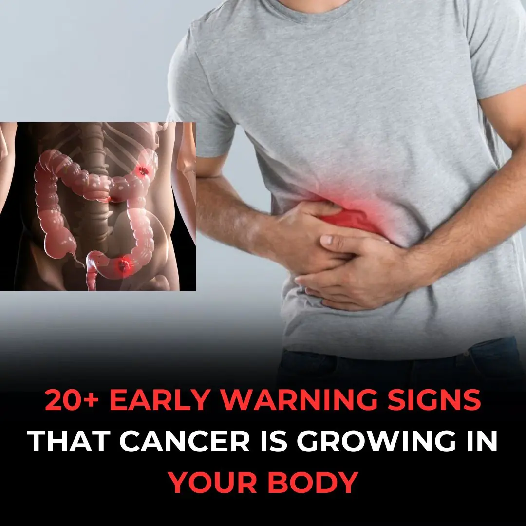 If You Spot These 20+ Signs Cancer May Be Growing In Your Body