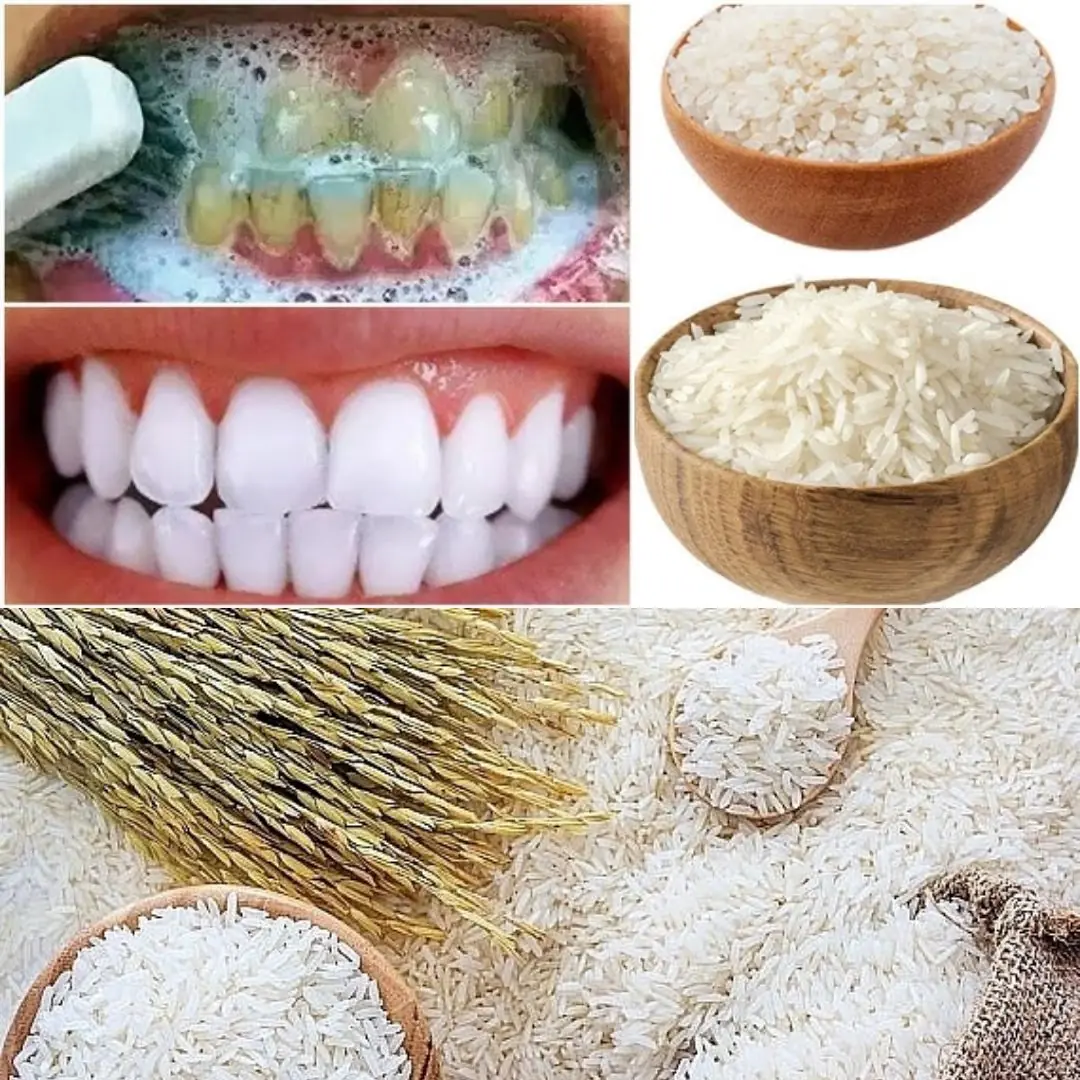 Achieve a Brighter Smile Naturally with Rice and Other Powerful Ingredients