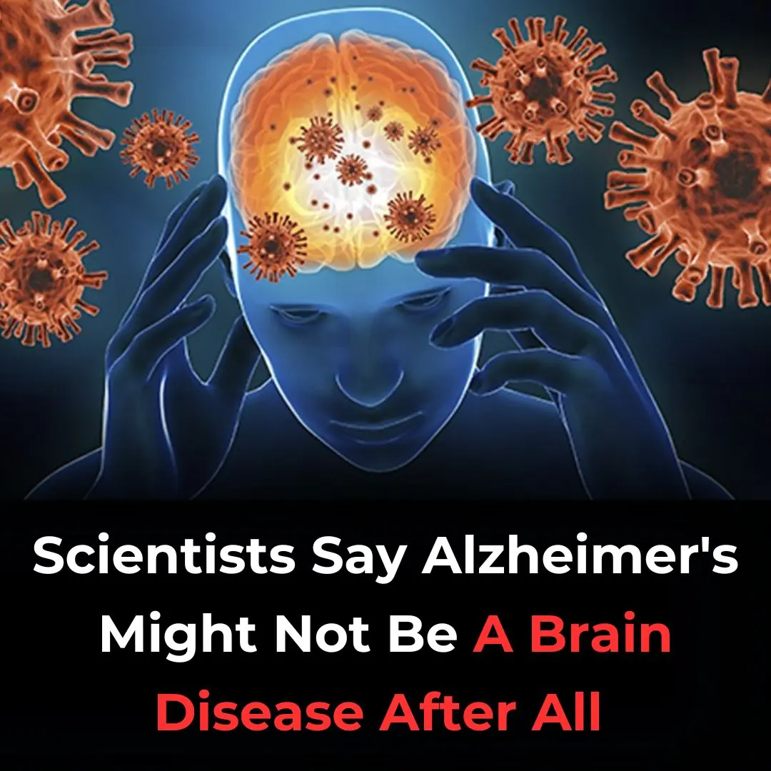 The theory that Alzheimer's is caused by the buildup of plaques in the brain is being challenged by a new theory.