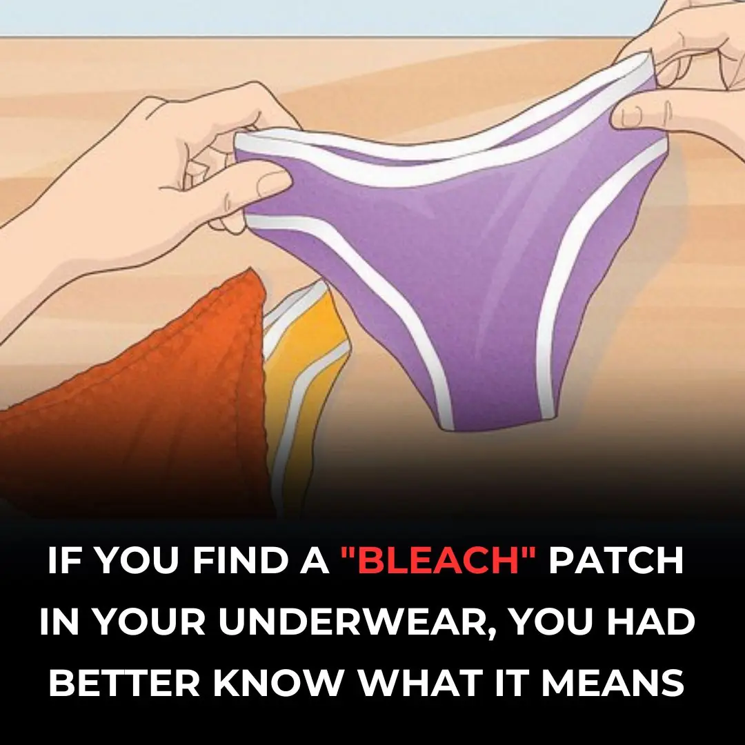 What a “Bleach” Patch on Your Underwear Means