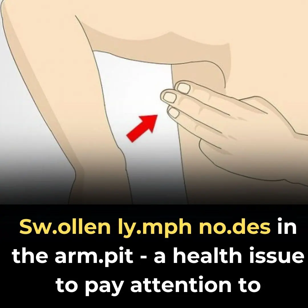 Sw.ollen ly.mph no.des in the arm.pit - a health issue to pay attention to