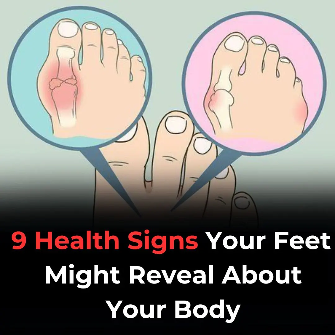 9 Health Signs Your Feet Might Reveal About Your Body