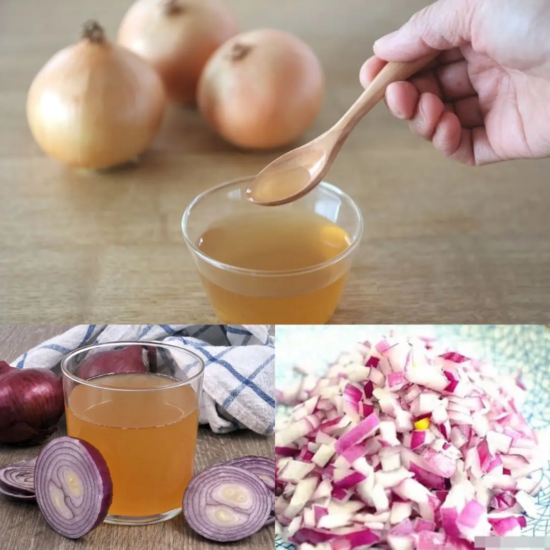 Onion: The Secret Ingredients For Thick Hair