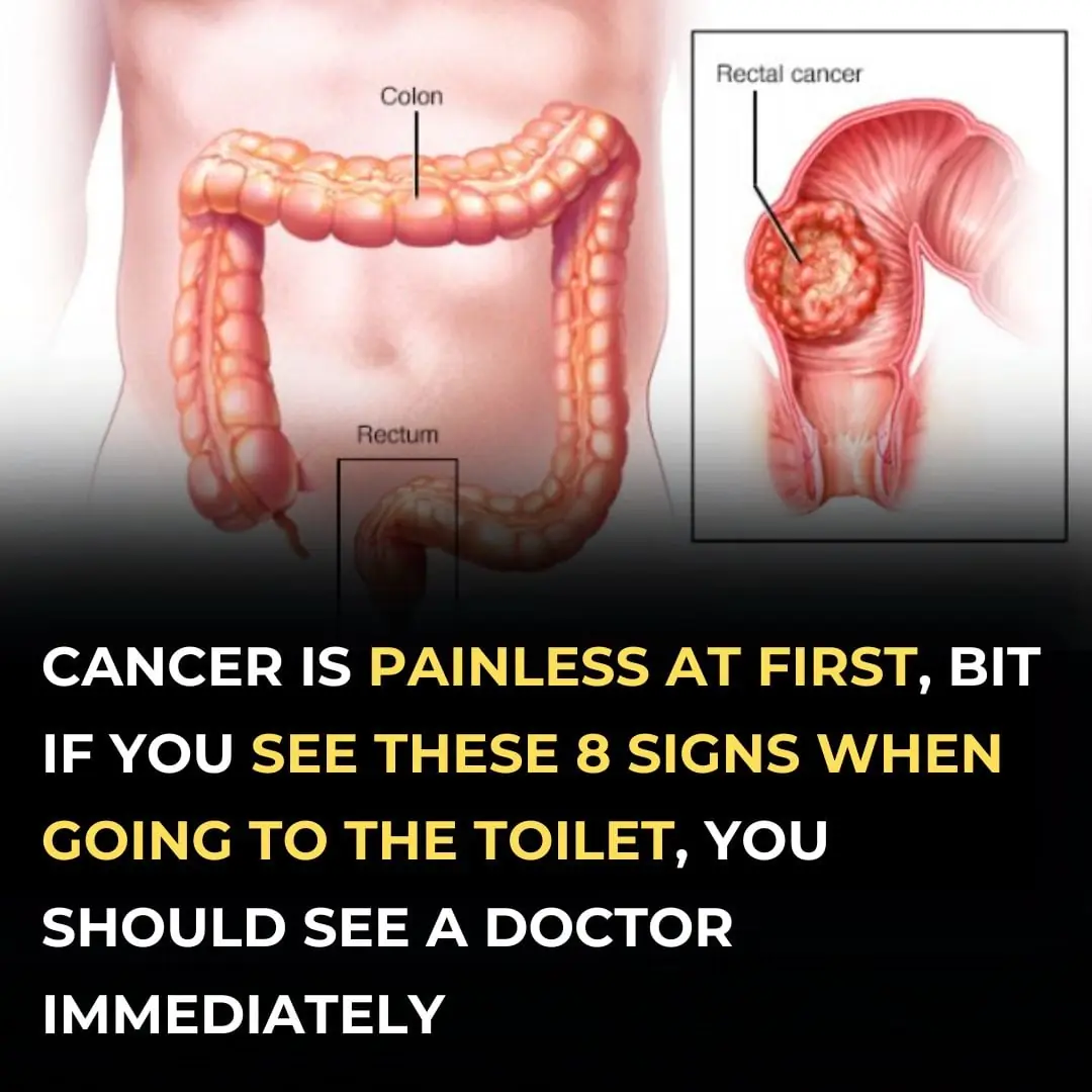 20 Cancer Symptoms That Are Often Overlooked