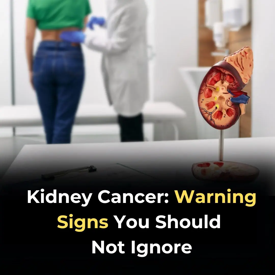 7 early warning signs that cancer is growing inside your kidneys