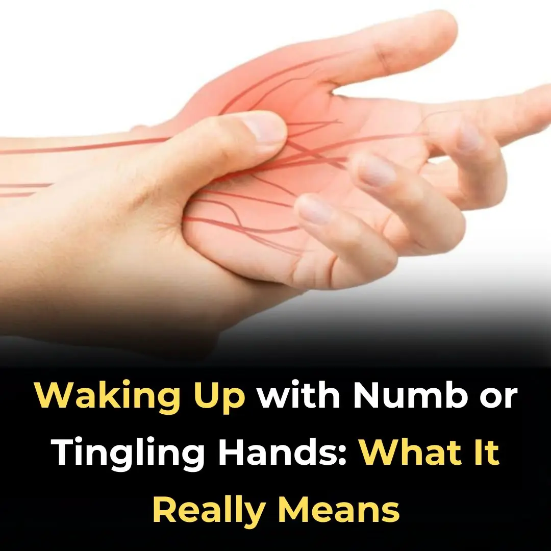 Waking Up with Numb or Tingling Hands: What It Really Means