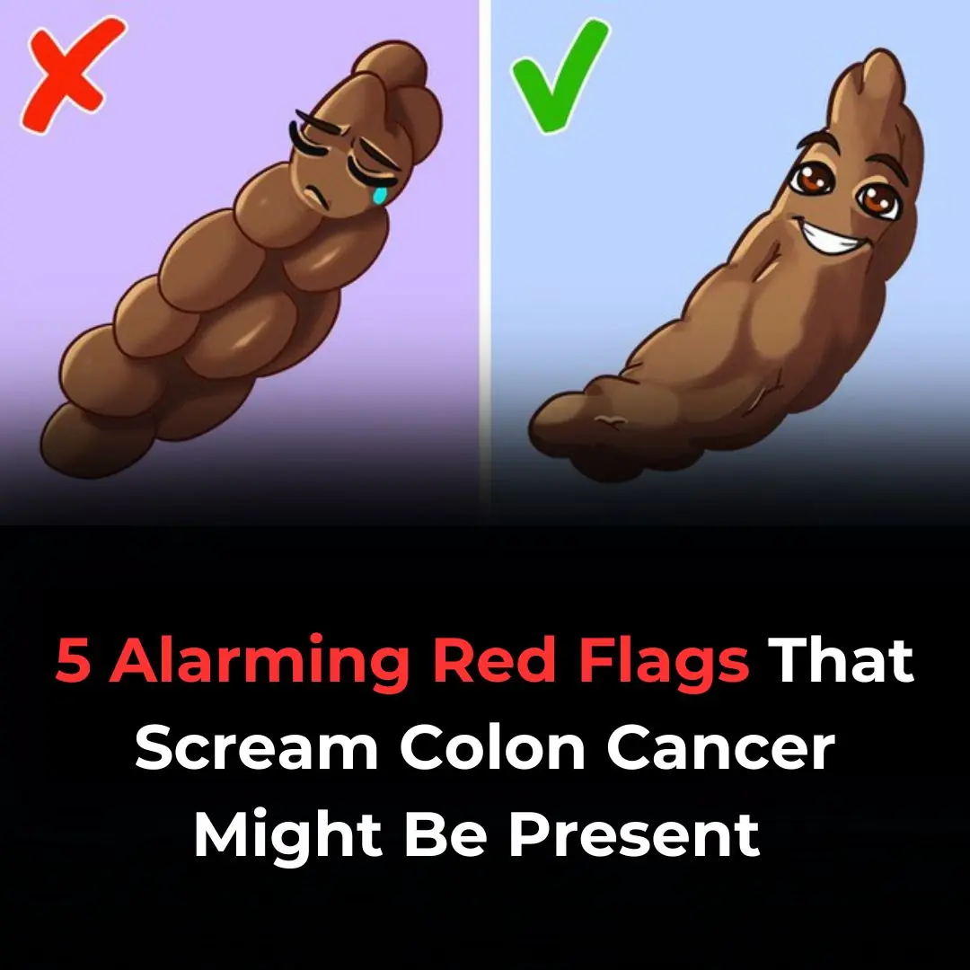 5 Concerning Red Flags That May Signal Colon Cancer