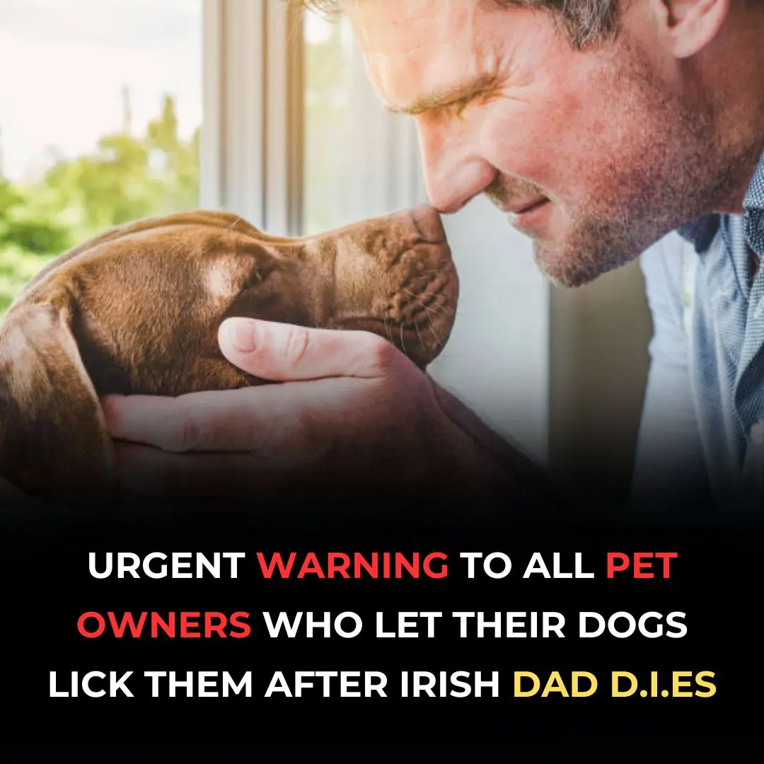 After A 49-Year-Old Father Of Two Passes Away, There Is An Urgent Warning For All Pet Owners Who Allow Their Dogs To Lick Them