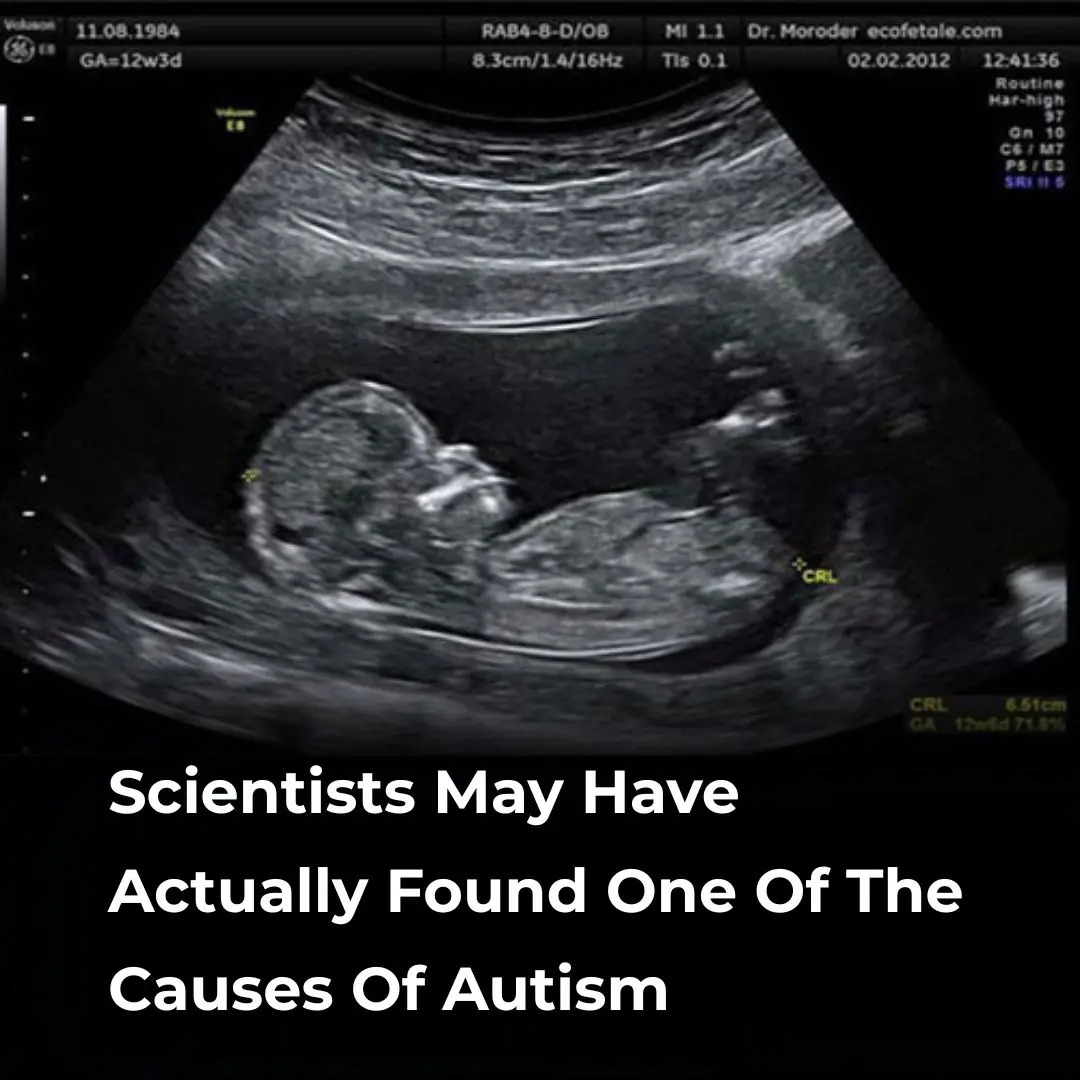 Scientists May Have Actually Found One Of The Causes Of Autism
