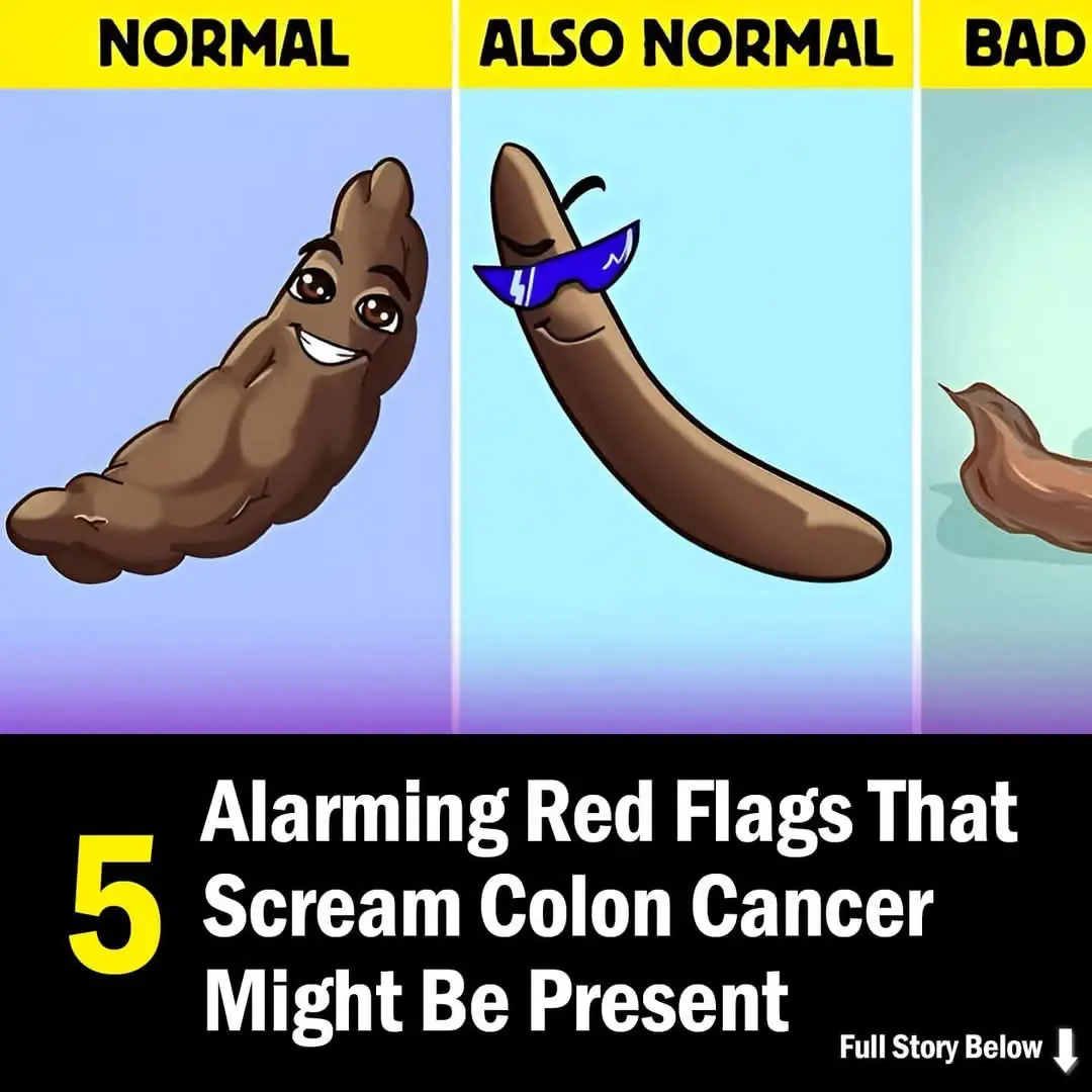 5 Early Signs of Colon Cancer You Shouldn’t Ignore