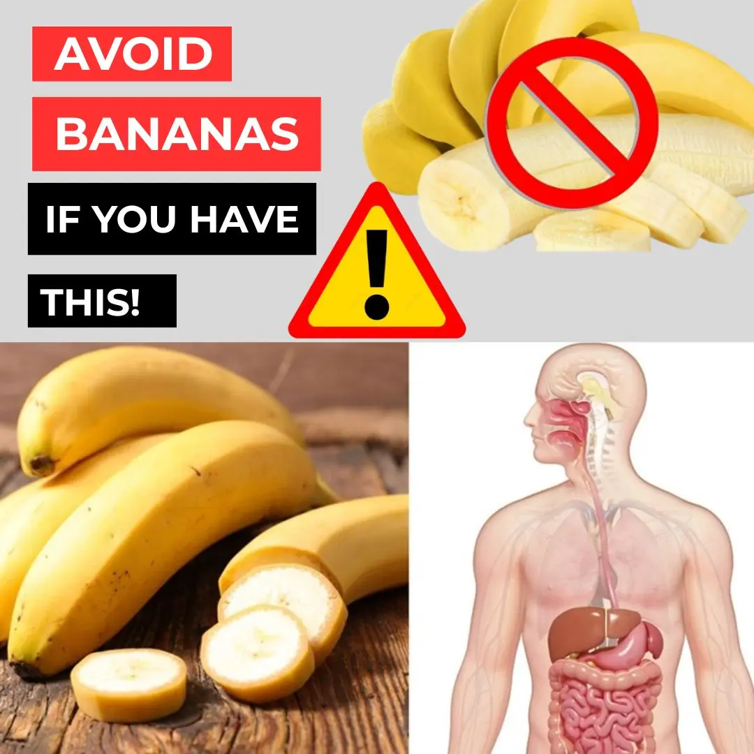AVOID Bananas If You Suffer From These 5 Health Problems!