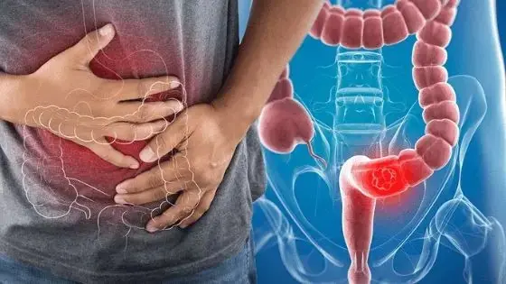 Warning from Cancer Hospital: Eating This Type of Meat Daily May Increase Cancer Risk – Don’t Take It Lightly!