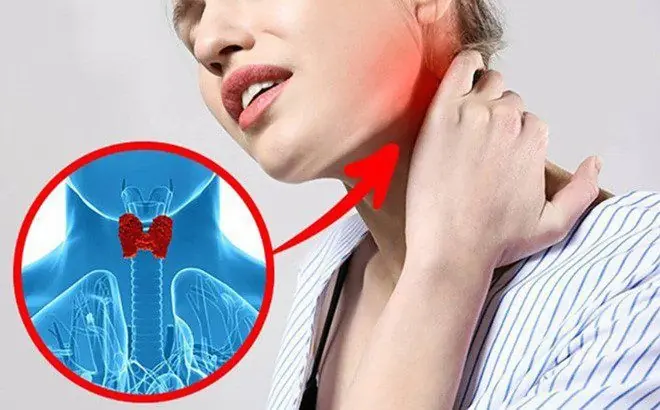 Thyroid Cancer Self-Check at Home with a Glass of Water: How I Detected It Early and Got Easy Treatment