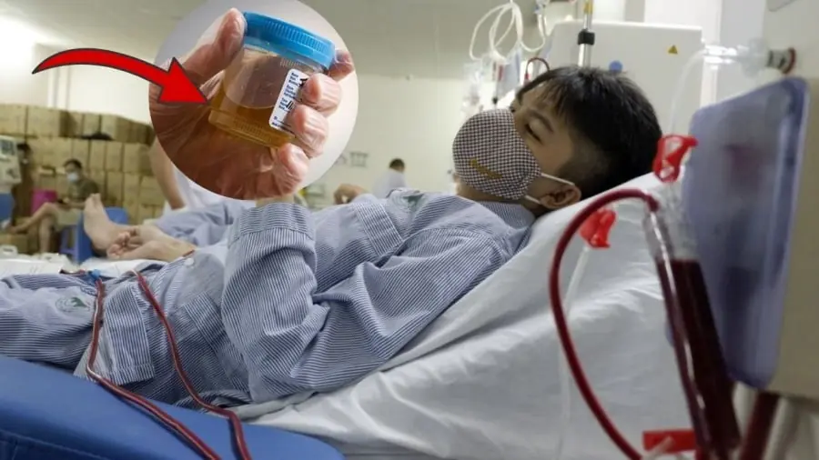 2 SIGNS OF KIDNEY DAMAGE: IF YOUR MORNING URINE HAS THIS COLOR, SEE A DOCTOR IMMEDIATELY