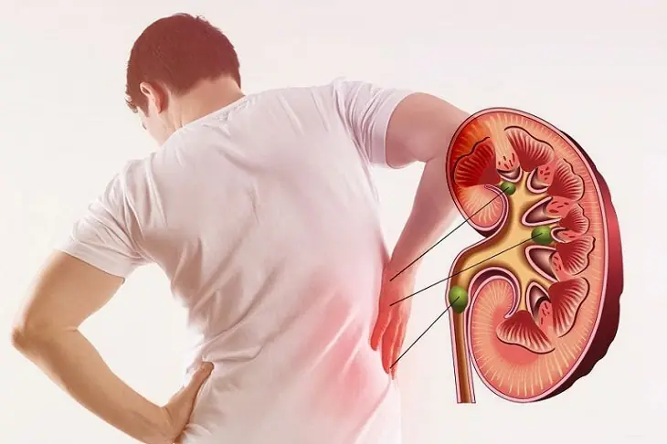 17-Year-Old Girl Hospitalized Due to Kidney Failure, Requires Lifelong Dialysis: Doctors Warn of 3 Common Habits Among Young People