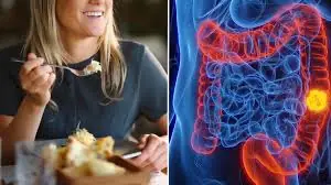 Professors blame one childhood eating habit for surge in colon cancer among Gen Z and Millennials