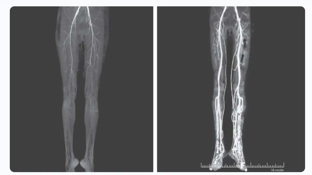 Woman Experiencing Burning Pains Turns Out To Have Medieval ‘Holy Fire’ Disease