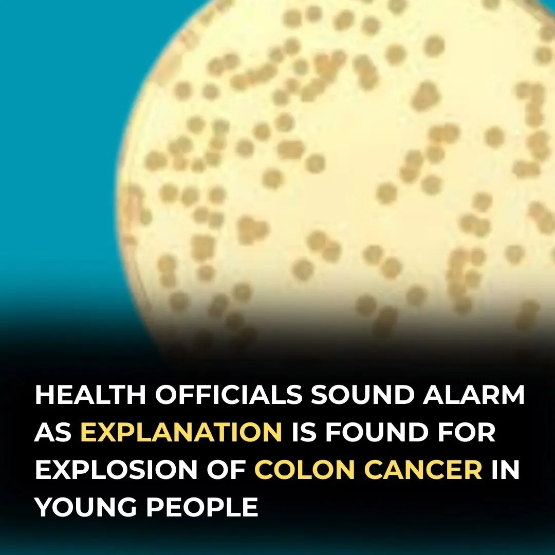 Alarming Rise In Colon Cancer Among Young People May Be Linked To Contaminated Salad, Study Finds