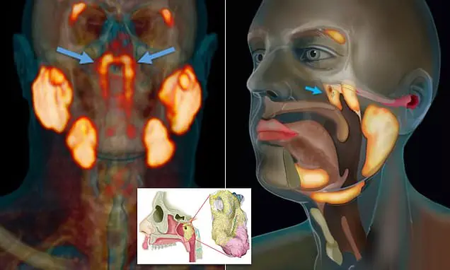 Scientists Accidentally Discover New Human Organ Hidden in the Head