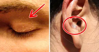 6 Subtle Facial Clues That Can Reveal Serious Health Conditions
