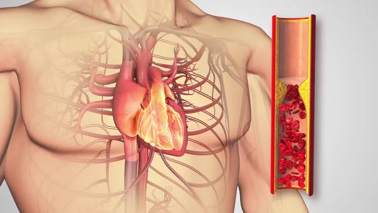 10 Warning Signs Your Body Might Be Giving You About Clogged Arteries