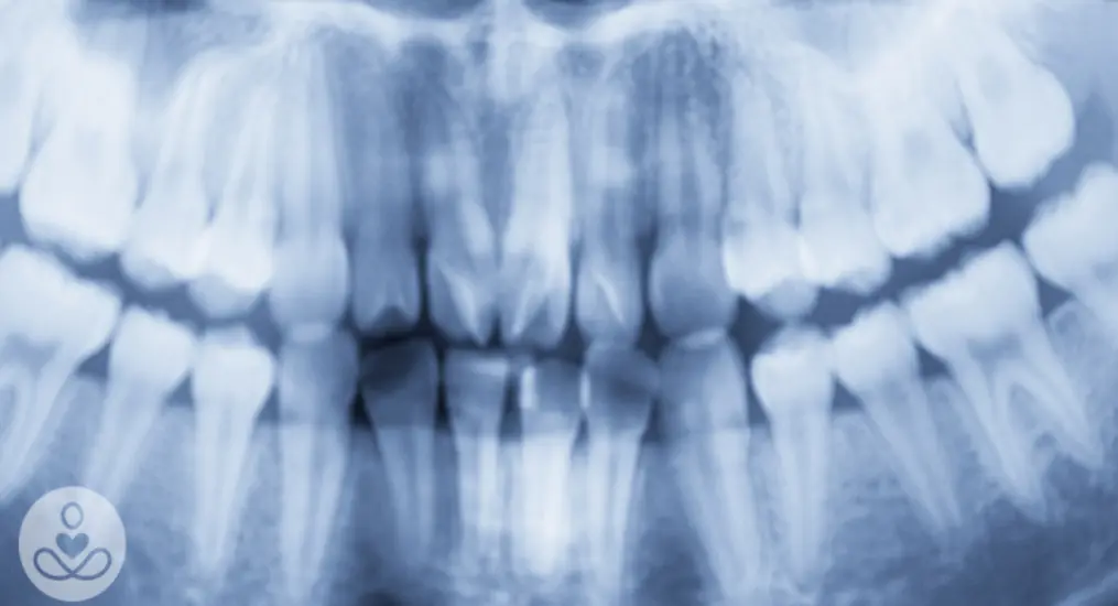 The Cause of Alzheimer’s Could Be Coming From Inside Your Mouth, Study Claims