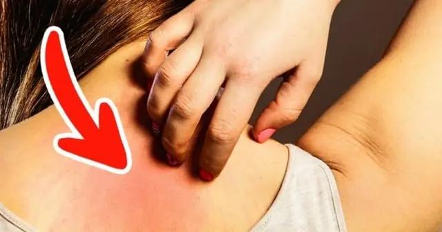 6 Warning Signs You Shouldn’t Ignore – Early Indicators of Cancer