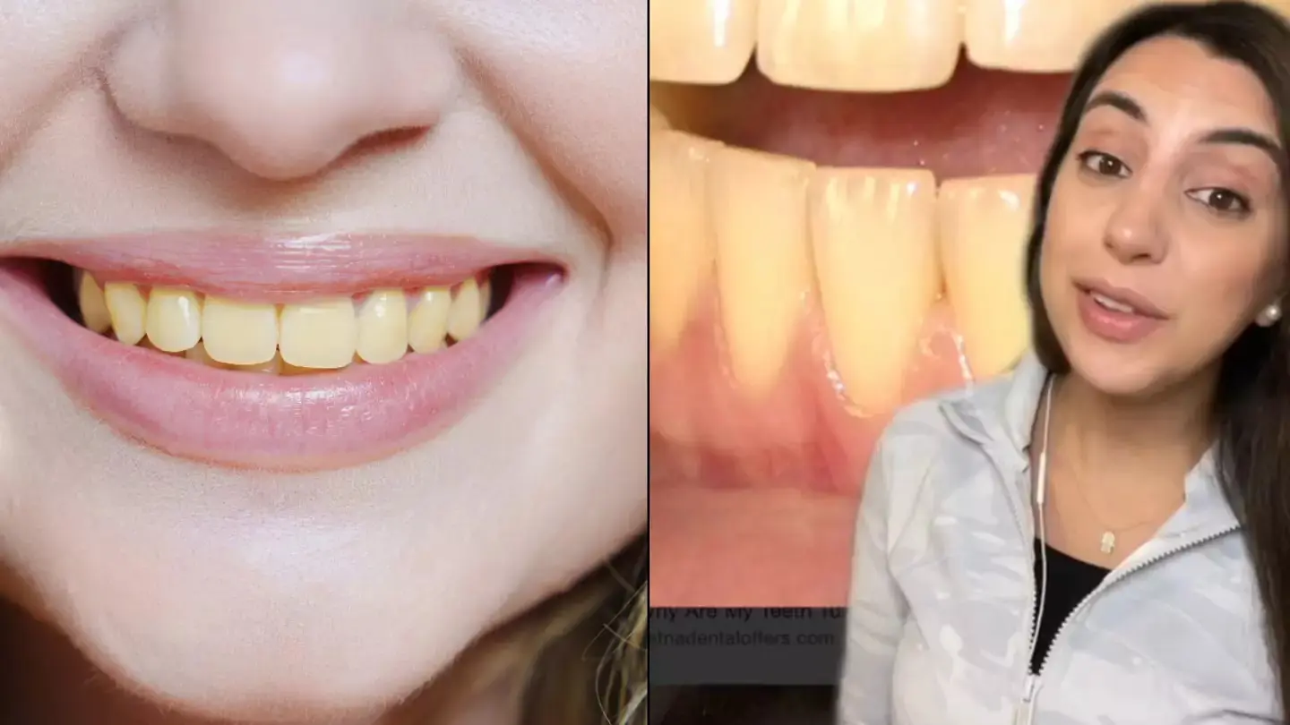 Dentist Explains 7 Key Causes of Yellowing Teeth and How to Prevent It