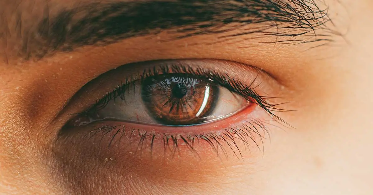 What Are Eye Floaters? Here’s What to Do If You Start Seeing Them, According to an Eye Doctor