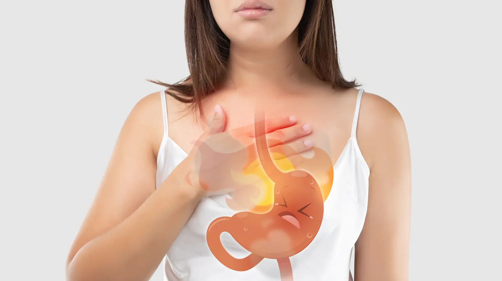 What Is Acid Reflux? Causes, Symptoms, and How to Treat It
