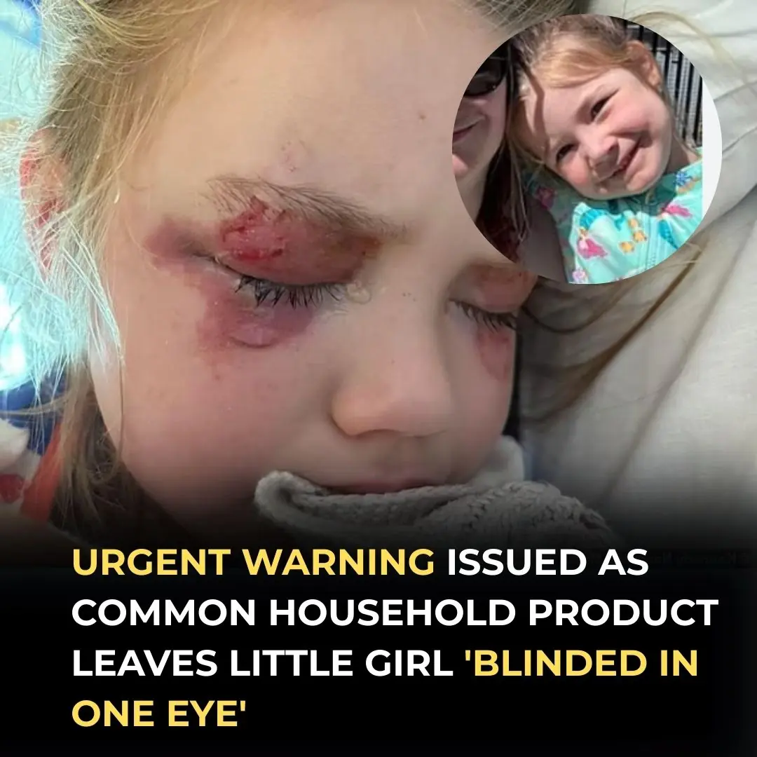 Urgent warning after girl is blinded from household product