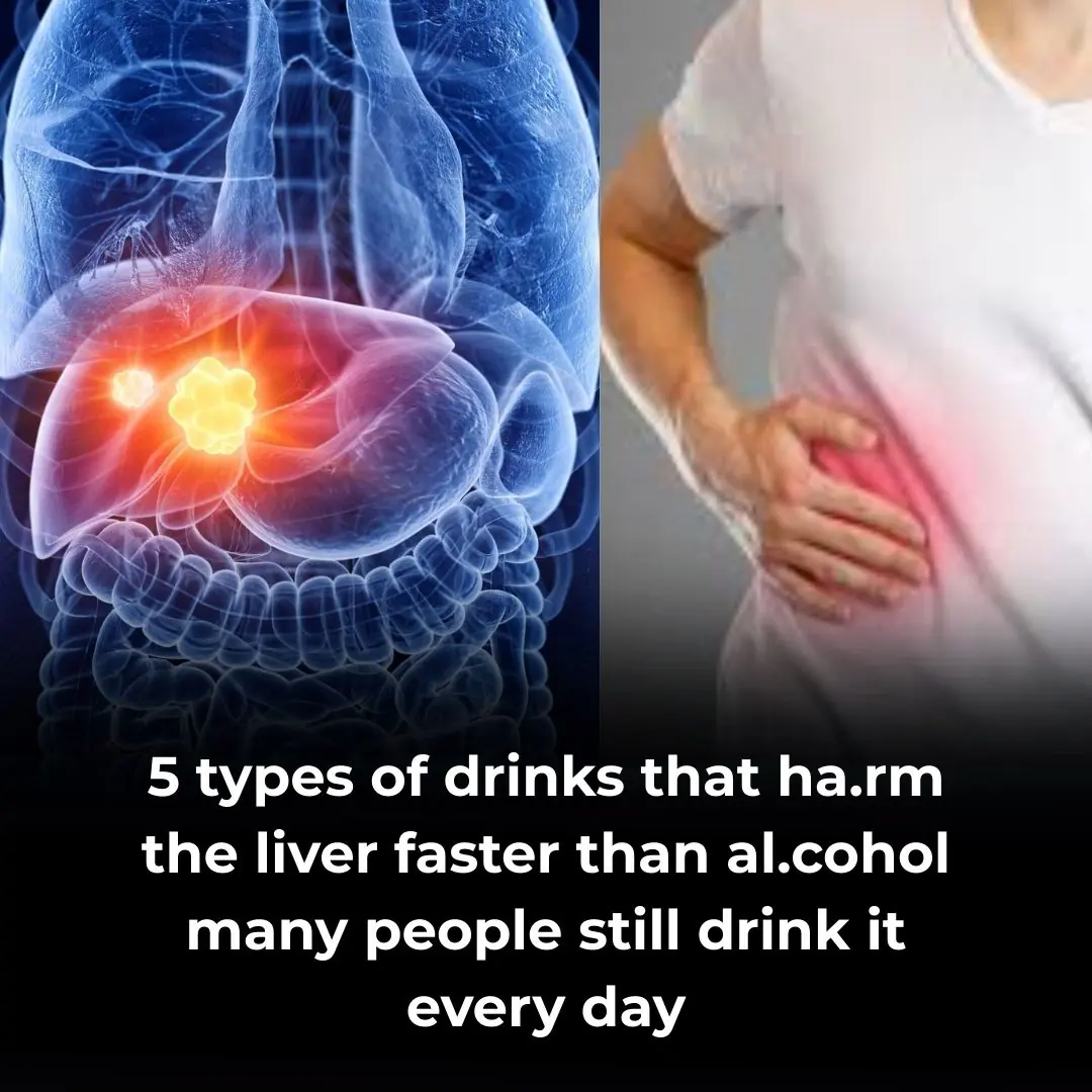 5 Common Food and Drinks That Can Be Just as Bad for Your Liver as Alcohol