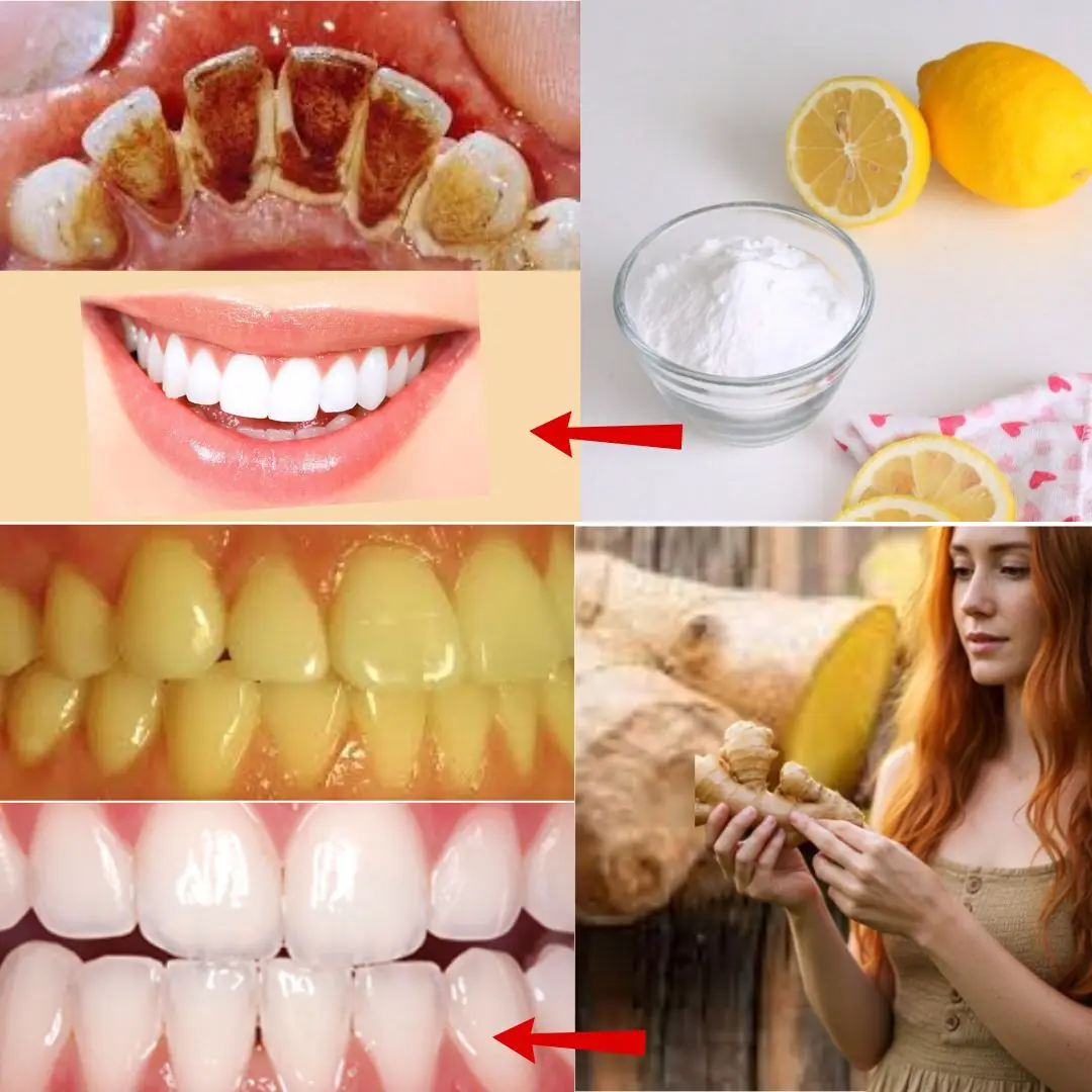 Whiten Your Teeth and Instantly Freshen Your Breath with the Natural Power of Ginger and Baking Soda