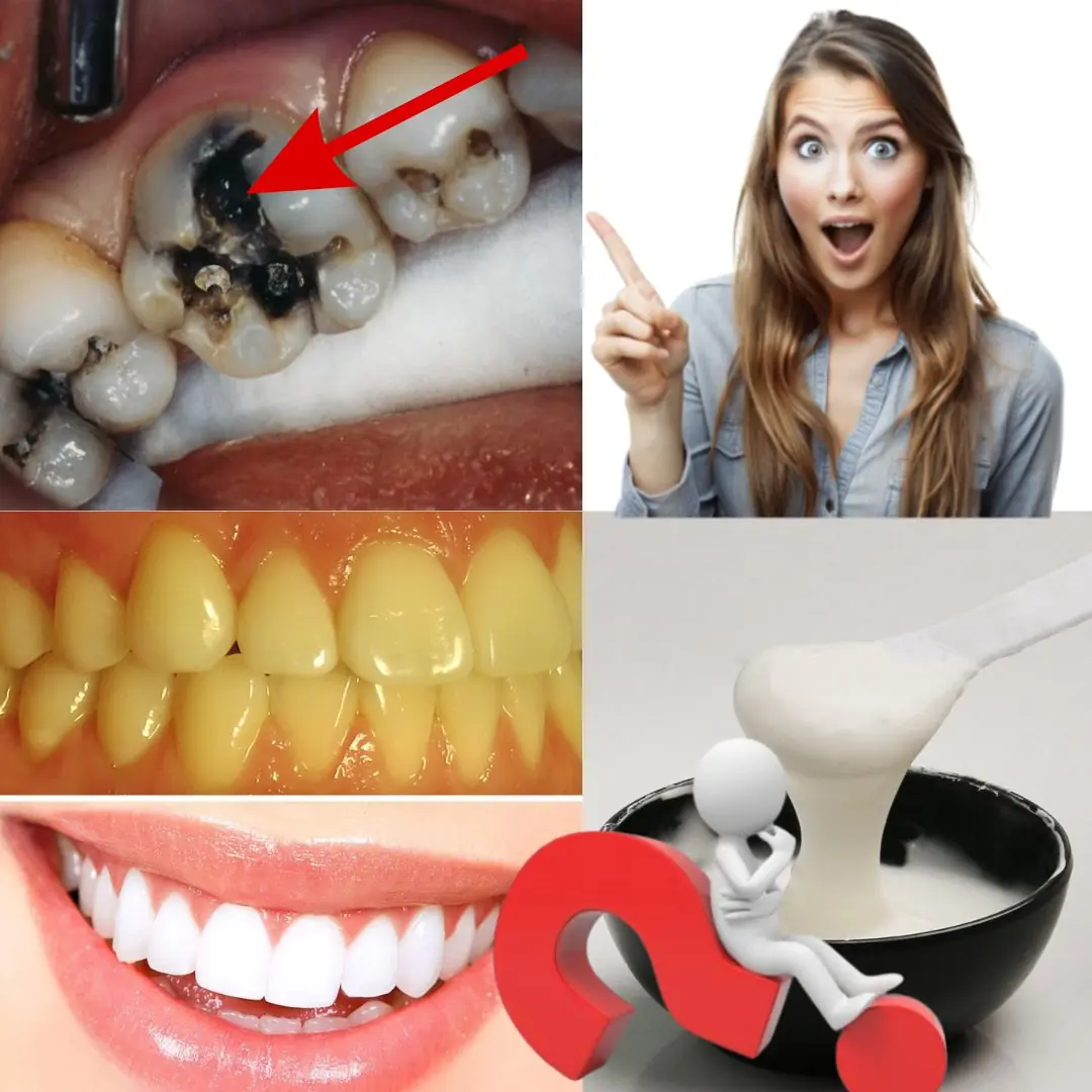 Naturally Reverse Early Tooth Decay: 6 Proven Tips to Strengthen Enamel and Fight Cavities!