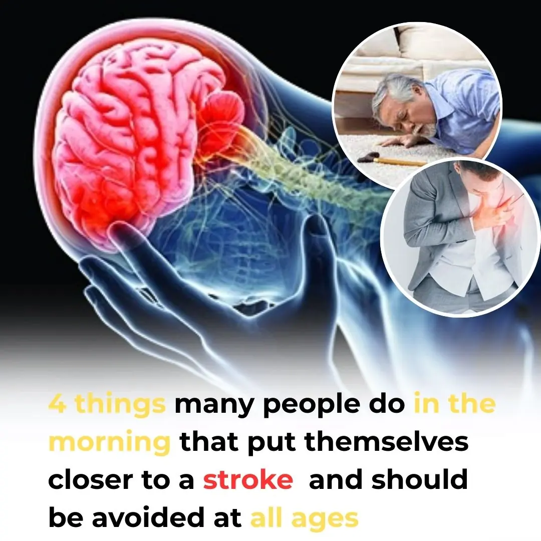 4 common morning habits that may increase your risk of stroke