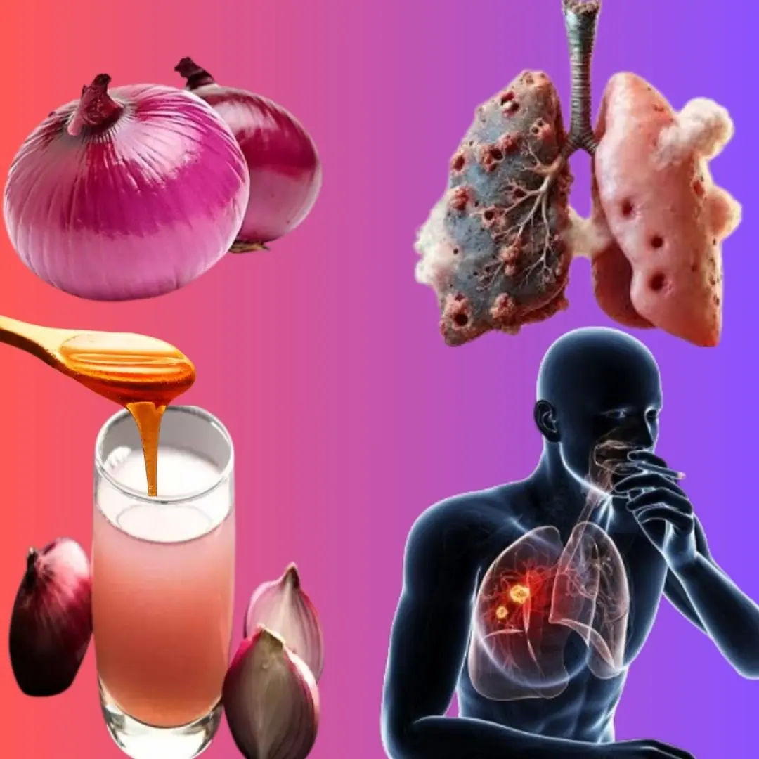 🌬️ Persistent Cough, Mucus Buildup, or Lung Congestion? Try This Powerful Natural Onion Remedy