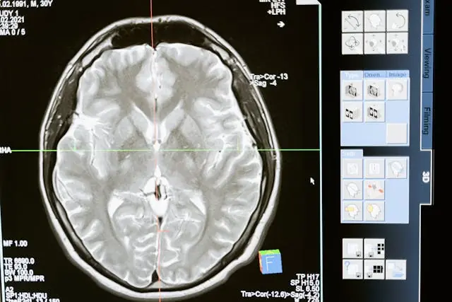 After Being Diagnosed With Dementia at 49, Man Realized The Subtle Red Flag in His Work That Made Him Realize Something Was Wrong