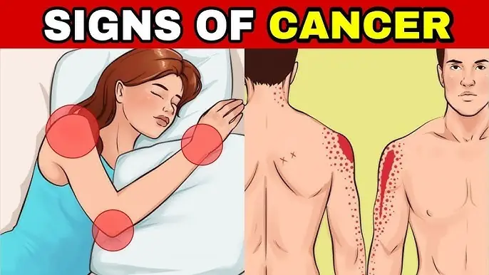 5 Early Cancer Symptoms You Must Not Overlook