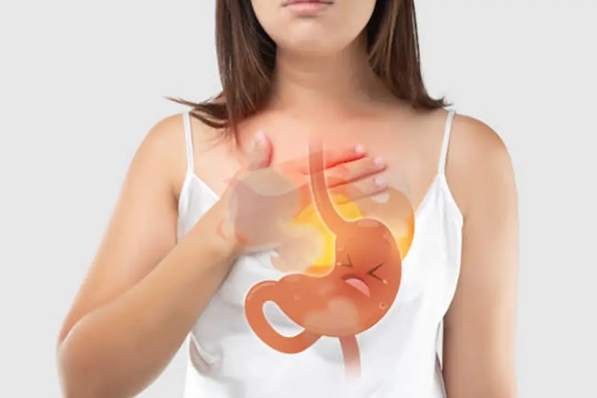 What Is Acid Reflux? Causes, Symptoms, and How to Prevent GERD